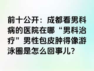 前十公开：成都看男科病的医院在哪“男科治疗”男性包皮肿得像游泳圈是怎么回事儿？
