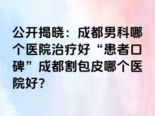 公开揭晓：成都男科哪个医院治疗好“患者口碑”成都割包皮哪个医院好？